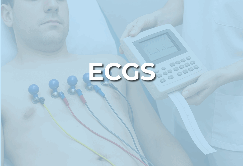 Image of an ECG being done with the word ecg across it