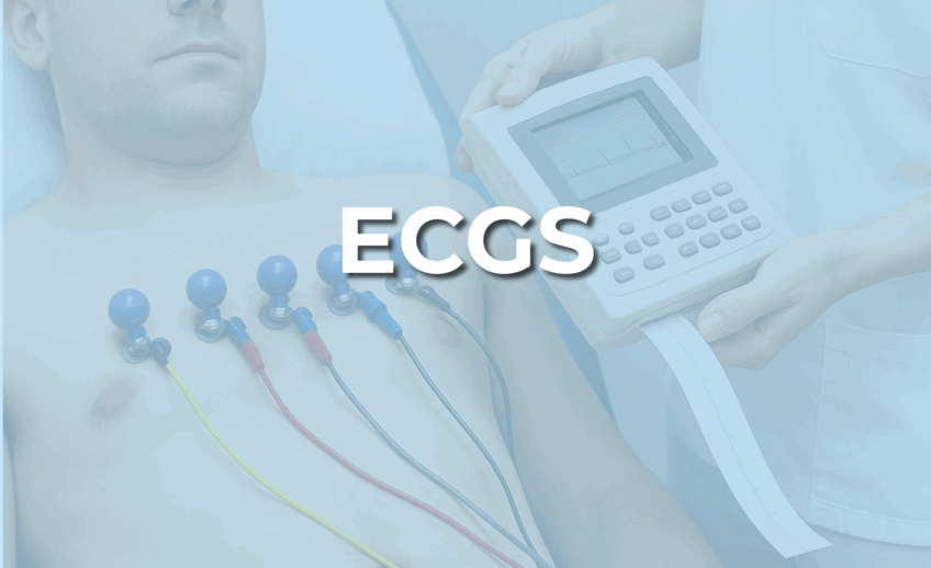 Image of an ECG being done with the word ecg across it